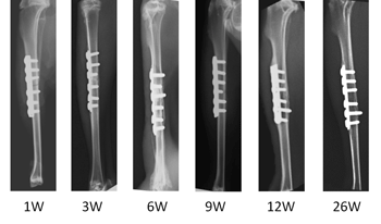 An in-vivo study of MIM 316L bone fracture fixation plates - Fig-1