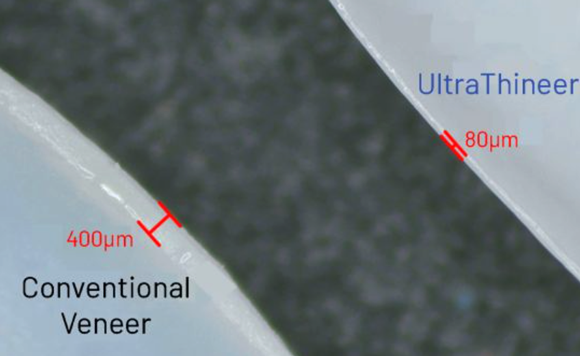 UltraThineers are three times thinner than traditional veneers (Courtesy BMF)
