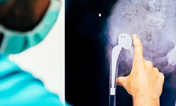 The EPMA Medical PM Seminar 2025 will showcase the use of metal powder technology in the medical devices and healthcare sectors (Courtesy EPMA)