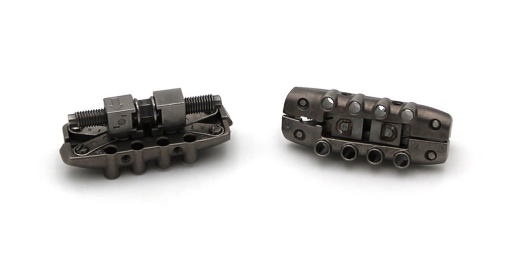 Fig. 8 INDO-MIM: A-to-Z orthodontic expander assembly for sleep apnoea (Courtesy MPIF)