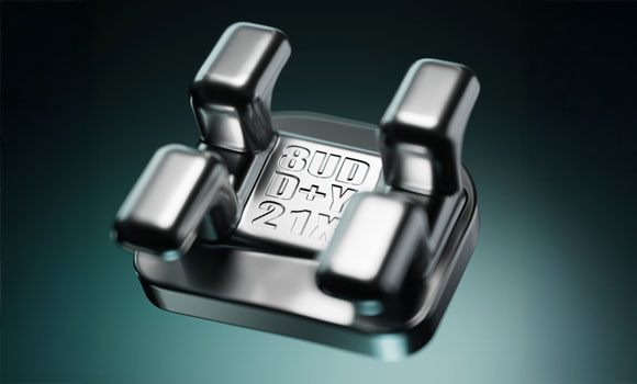 LightForce has introduced the additively manufactured LightBracket Metal (Courtesy LightForce Orthodontics)