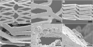 Fig. 3 SEM images of MIM 316L stainless steel vascular stents in expanded (a, b), and folded (c, d) states, and powder particles affiliated to stents (e, f) (From paper: ‘Biocompatibility of vascular stents manufactured using metal injection moulding in animal experiments’ by Chang Shu, et al., Transactions of Nonferrous Metals Society of China, Vol. 32, 2022, 569-580)